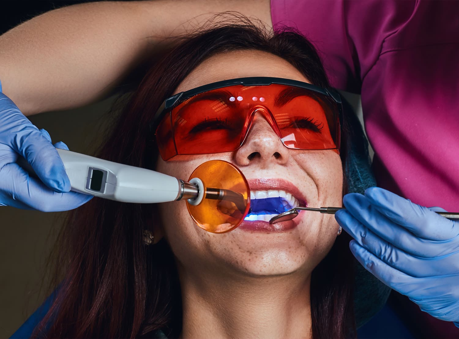 Porcelain Fillings Whitedent Dent Clinic